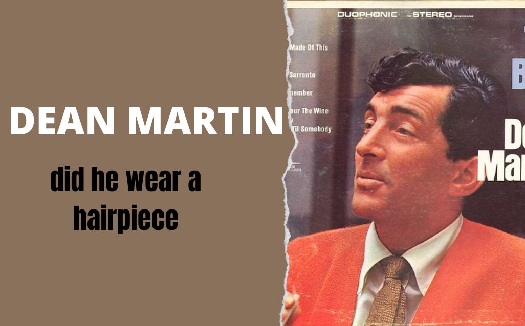 Did Dean Martin Wear A Hairpiece?